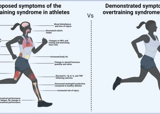 Overtraining Syndrome: Causes, Symptoms, Recovery, and Prevention Guide for Athletes