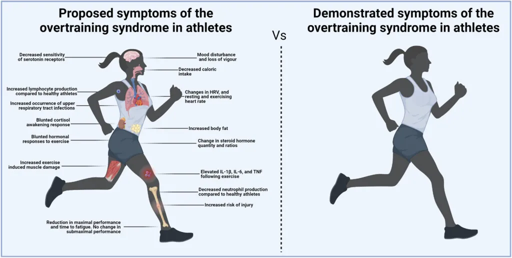 Overtraining Syndrome: Causes, Symptoms, Recovery, and Prevention Guide for Athletes
